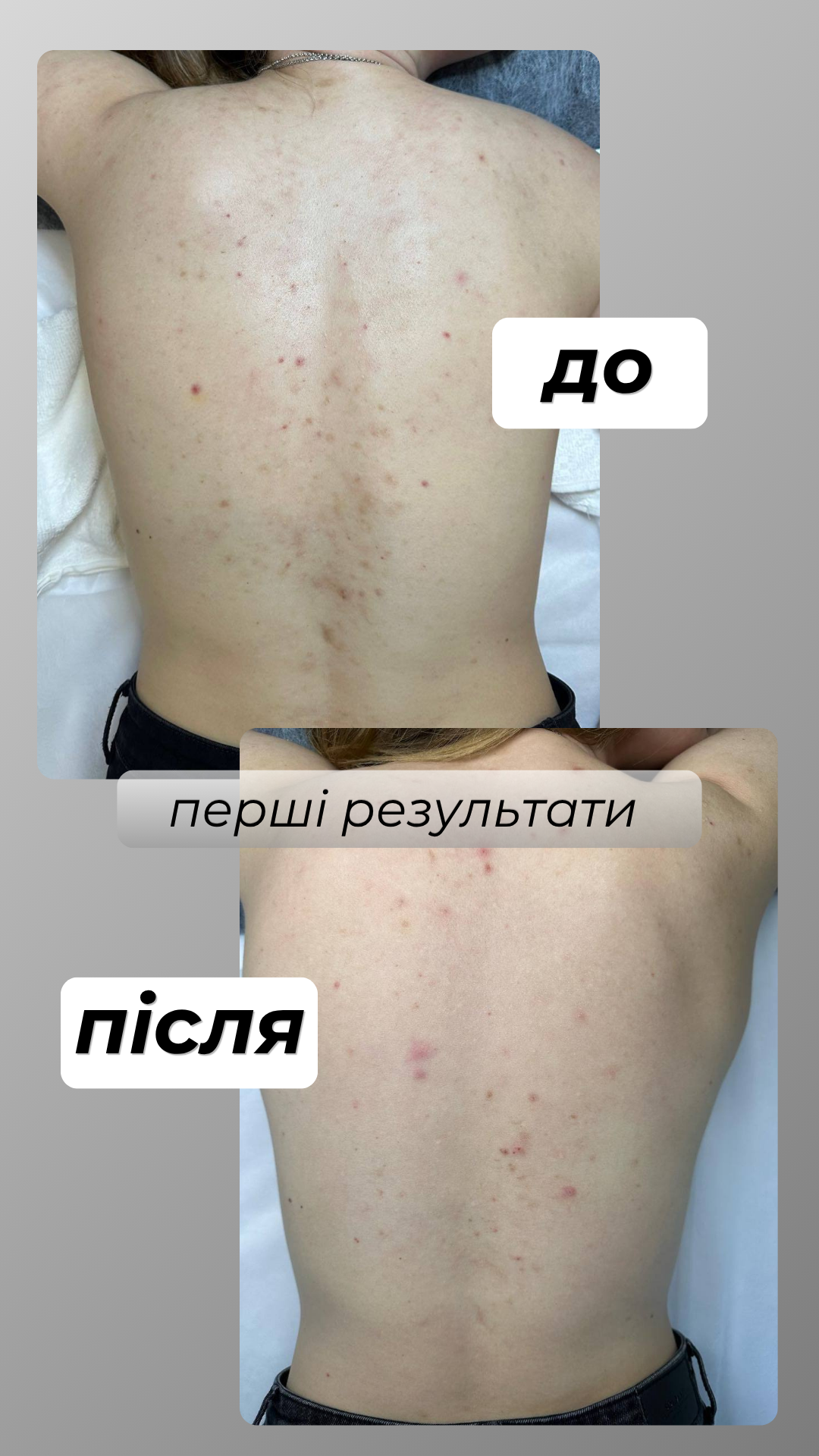 LORÉTO — результат до та після, фото 4