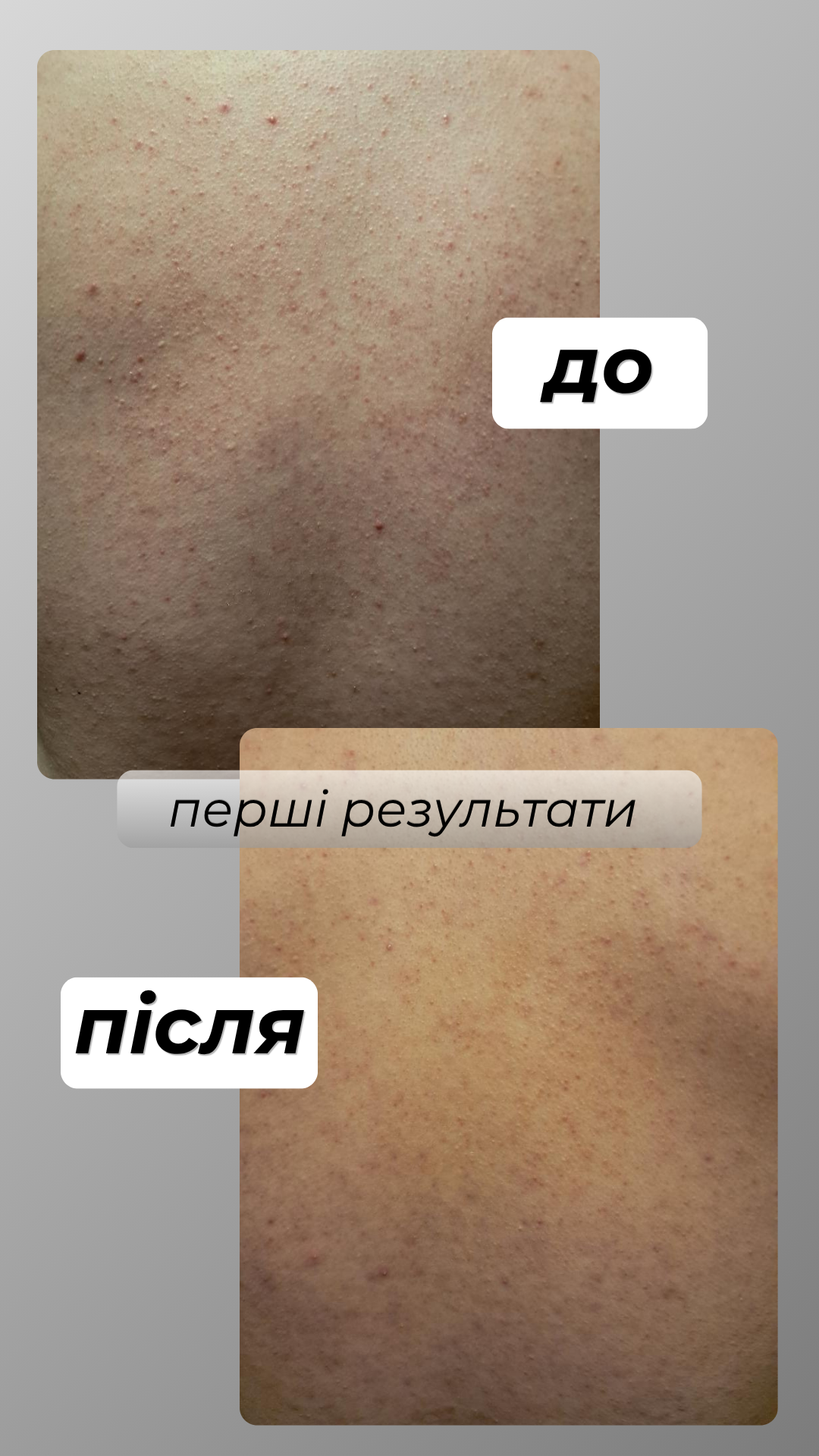 LORÉTO — результат до та після, фото 4