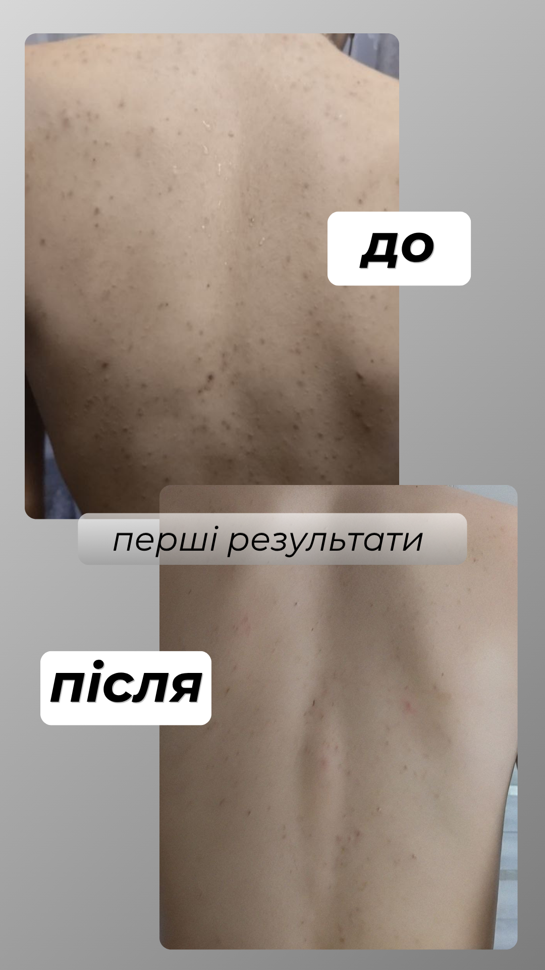 LORÉTO — результат до та після, фото 4