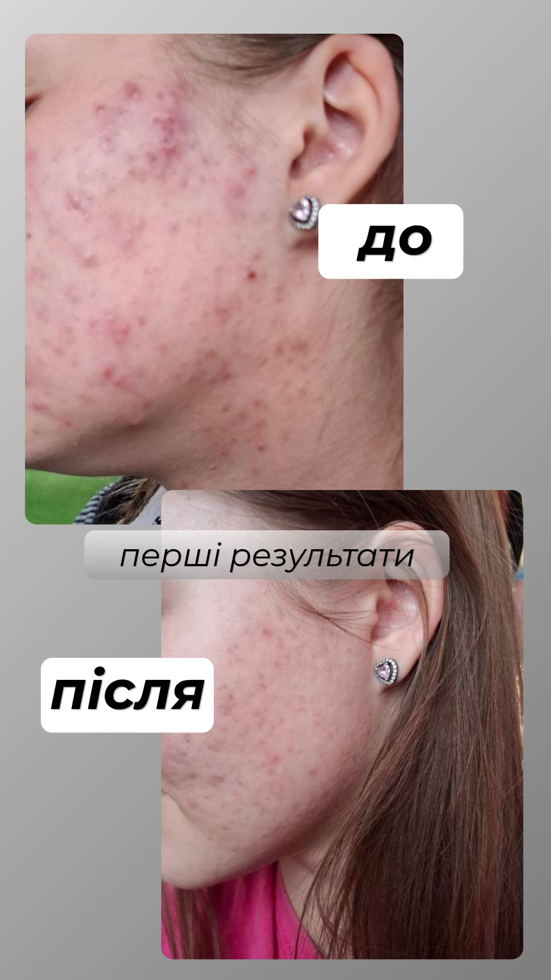 LORÉTO — результат до та після, фото 4